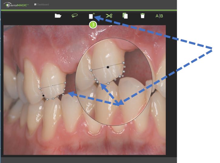 dental treatment on digital screen